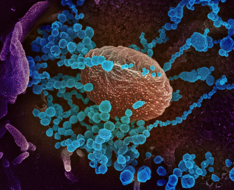 Et av bildene National Institute of Allergy and Infectious Diseases, NIAID, har lagt ut av SARS-CoV-2-viruset isolert fra pasienter ved hjelp av et transmisjonselektronmikroskop.